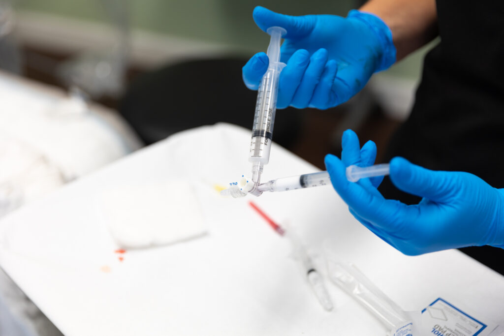 The provider prepares the Varithena injection by mixing the solution for venous deficiency treatment near Sarasota