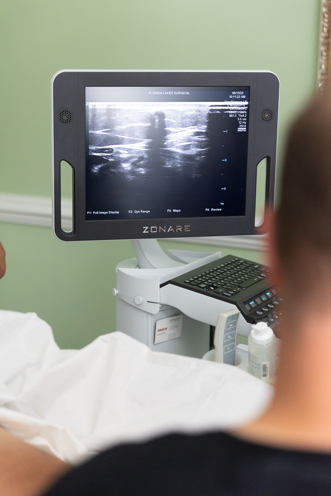 This Common Vein Problem: Are You One Of The Millions Affected? - ilk8qcp