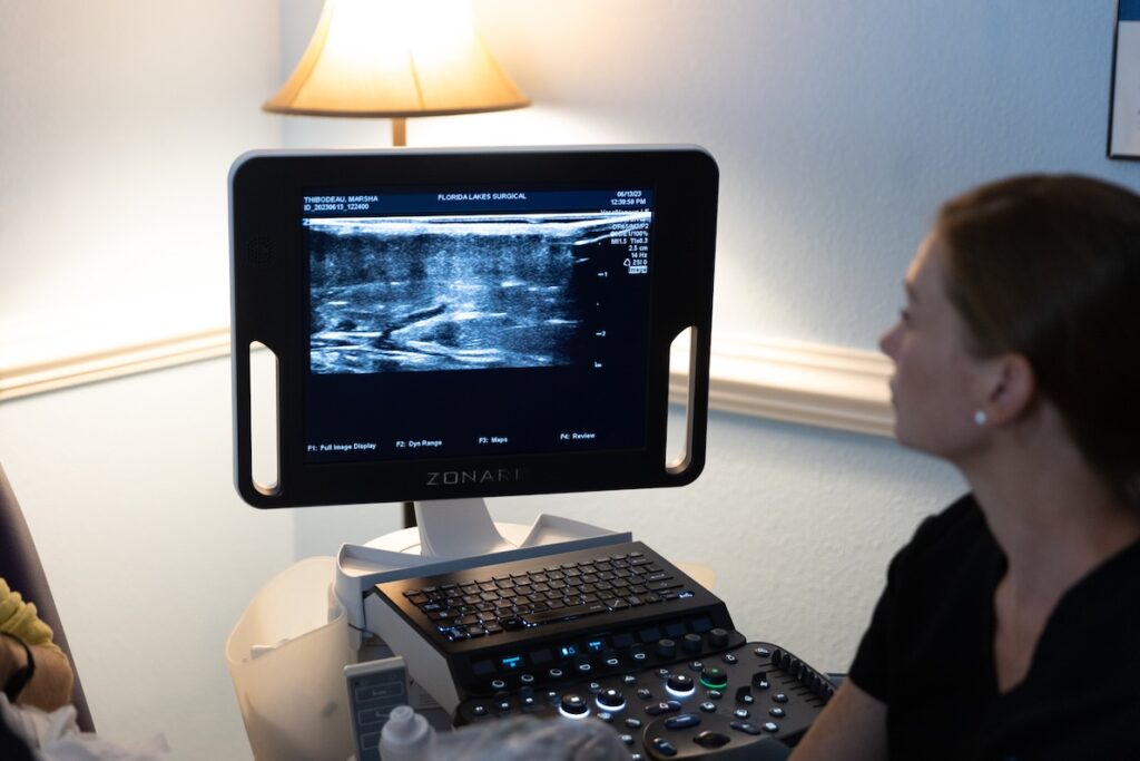 A female provider looks at an ultrasound screen as she is examining a vein for DVT treatment in Lakewood Ranch.